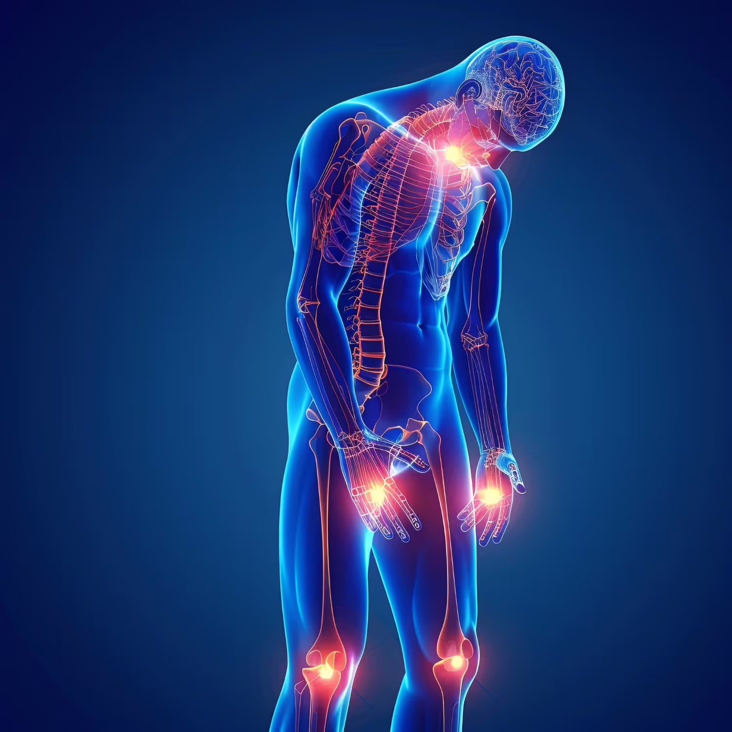 Chronic Inflammatory Response Syndrome "CIRS"